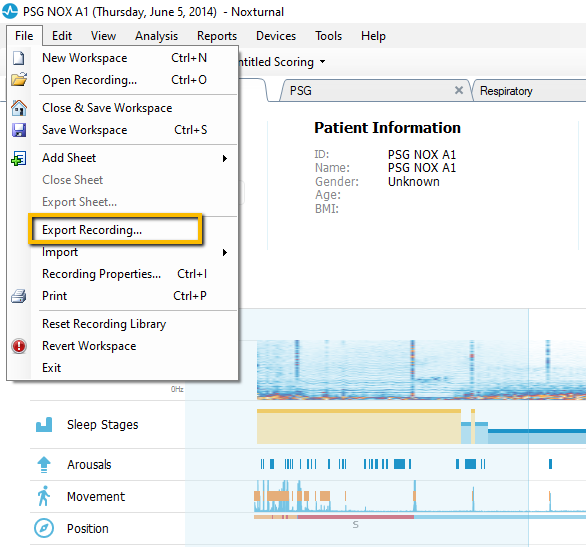 Export selection window for RemLogic recordings. Noxturnal