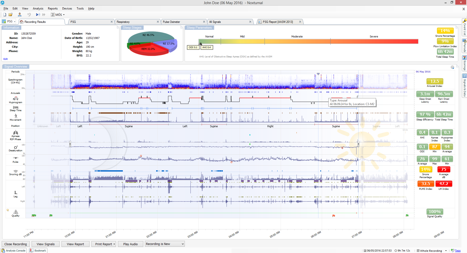 a1 website analyzer free download a1 website analyzer free download